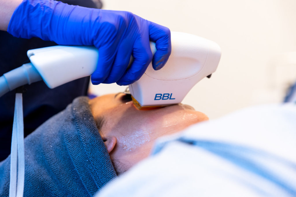 skincare professional using BBL machine on patient's face