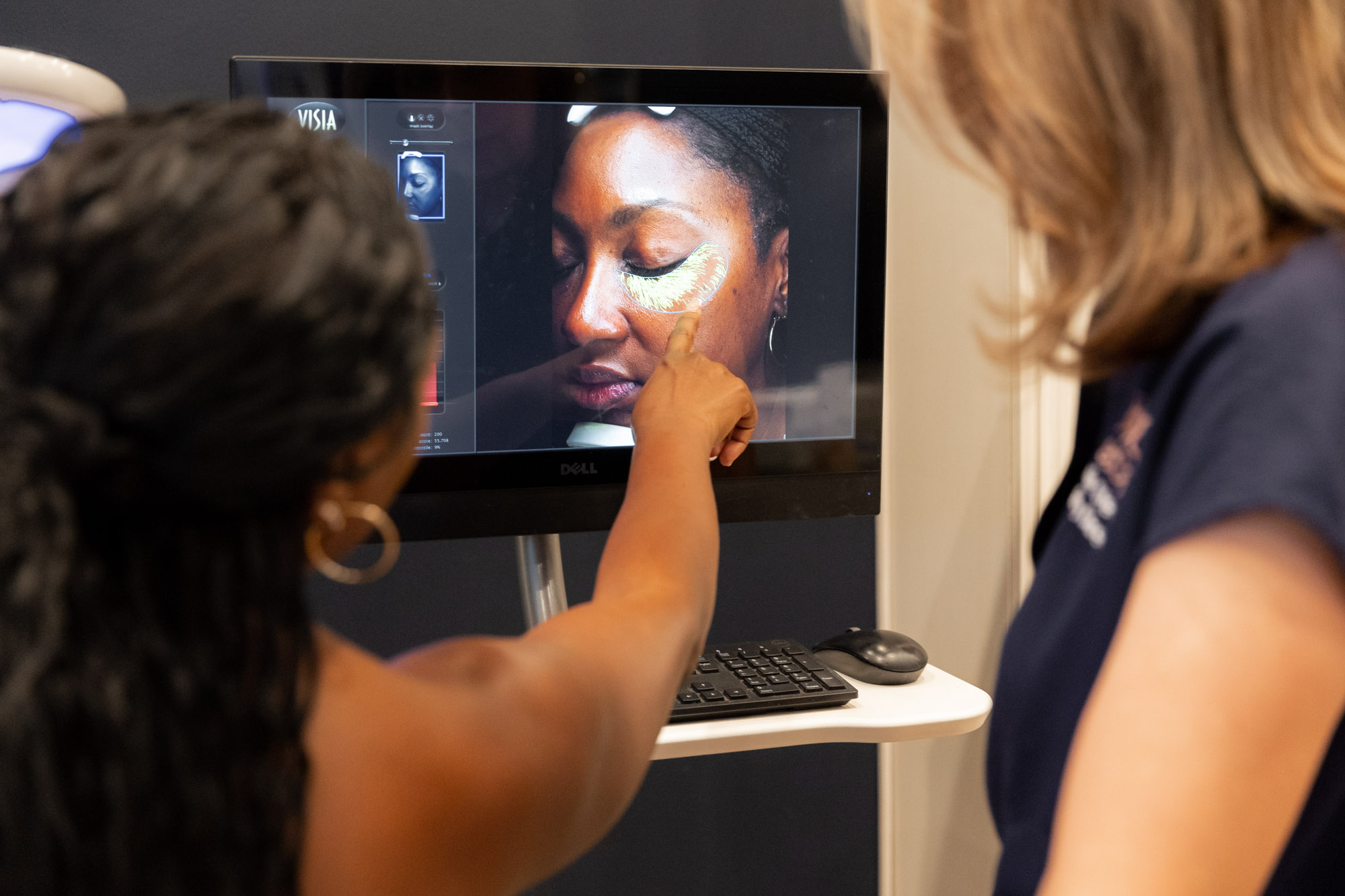 Touch provider and patient examining VISIA skin analysis results